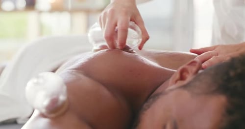 Therapist using cupping therapy to treat a patient in clinic