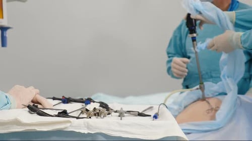 Surgeons Team During Process Operation Gallbladder Removal with Surgical Laparoscopy Instruments