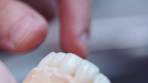 Close Up Man Dentist Hands Setting Dental Tooth Crown on Jaw Model Working on Dentures Use