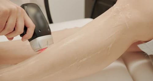 Laser Hair Removal Treatment on Woman's Leg