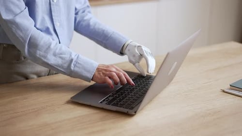 Close View of Young Woman with Bionic Hand is Typing on Laptop at Table in Home Room Spbas