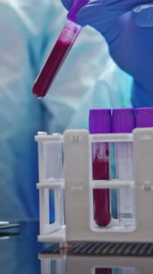 Medical Professional Analyzing Blood Samples in Test Tubes