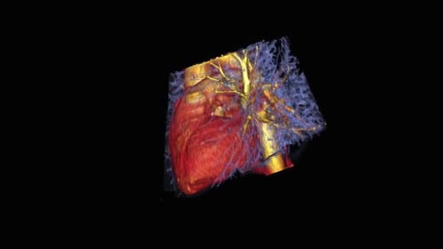 3D Rotating Human Heart Medical Scan with Blood Vessels