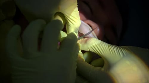 Slow motion vertical shot of a dentist wearing green latex using articulating paper to check the fit