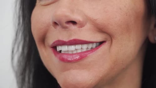 Closeup of Woman's Smile After Installing Zirconia Veneers Dental Ceramic Crowns Female Patient