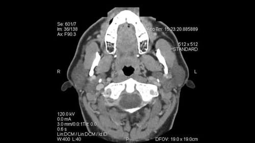 Axial Tomography: CT Scan layers from top of head to mid-thoracic