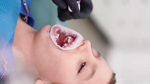 Woman Doctor in Dental Clinic Serve Patient Little Boy with Damaged Baby Teeth