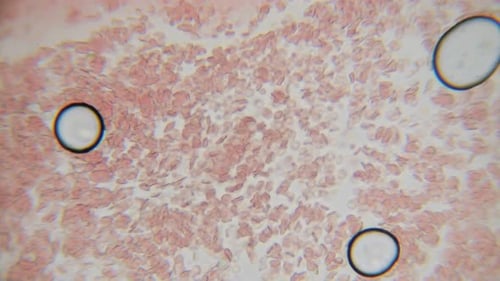 Fresh blood seen on a 400x microscope view. Blood smear under microscope present plasma