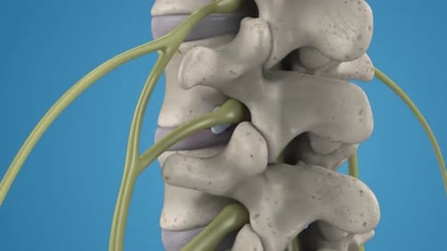 3D Animation of Lumbar Spine and Nerve Compression