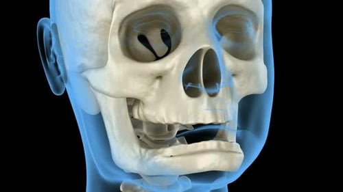 Mandibular Jaw, bone recession after losing teeth.