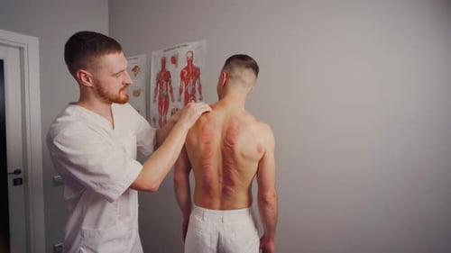Physical Therapist Examining Patient After Cupping Therapy