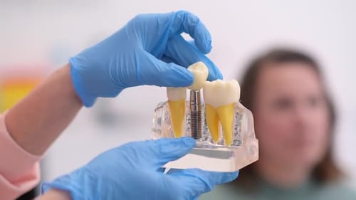 Dental Implant Demonstration in Clinic