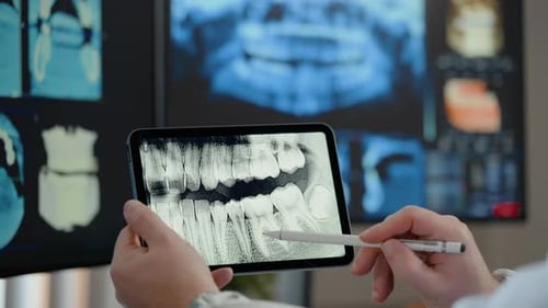 Dental Scan on Tablet at Dentist Office