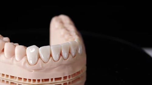 Dental Cast on Rotating Surface Close Up