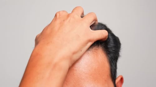 Man Scratches Scalp with Curly Dark Hair