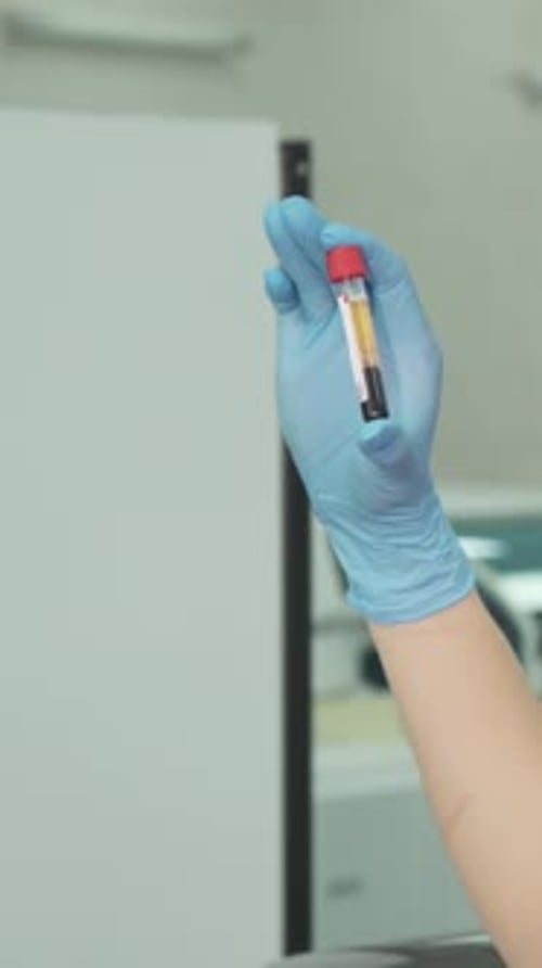 Blood Sample Analysis in a Medical Lab