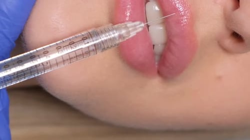 Lip Injection Procedure in Close Up Shot
