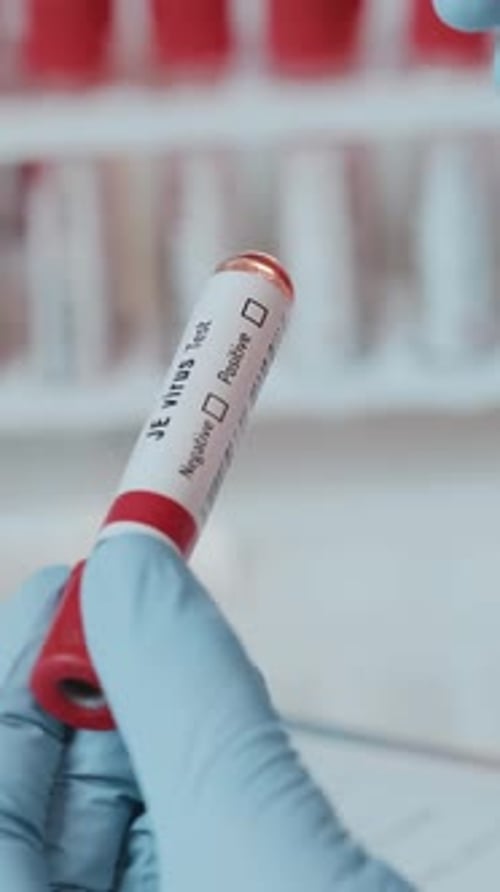 Healthcare Professional Analyzing Blood Test Tube for JE Virus in Clinic