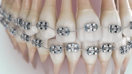 Brackets Up 16x9 006