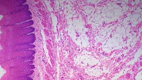 Stratified Squamous Epithelium in Section Filmed By Microscope 200x Against Bright Field