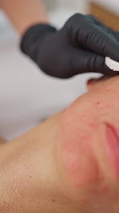 Woman Receives a Cosmetic Procedure on Face