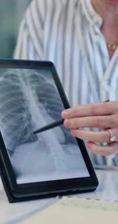 Doctor, hands and tablet for xray, healthcare and osteoporosis advice or treatment in office