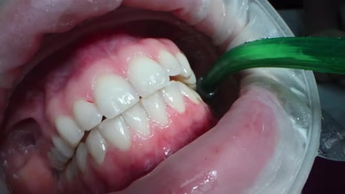 Dental Extreme Close Up Makrovideo Zahnreinigungsprozess im Mund des Patienten Zähne mit Wasser reinigen
