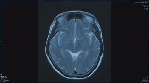 Dynamic Human Brain MRI Scan Medical Imaging Animation