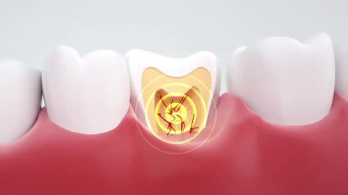Animated Toothache with Pulsating Pain Signals