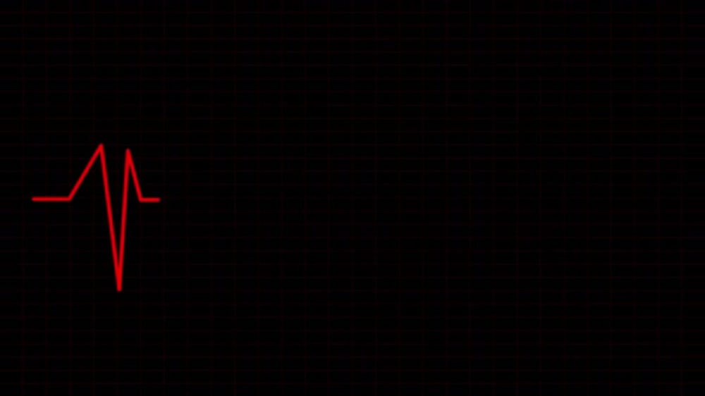 Red EKG Heartbeat Line Animation on Dark Grid Background, Backgrounds ...