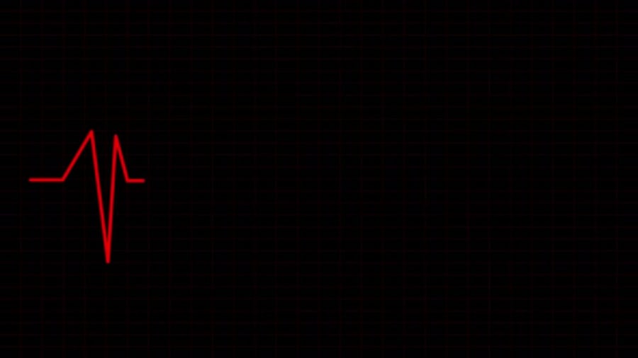 Red EKG Heartbeat Line Animation on Dark Grid Background, Backgrounds ...