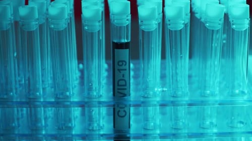 Close-up of COVID-19 Blood Test Tube