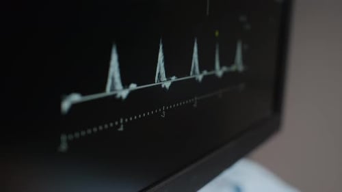 Electrocardiogram Monitor Displaying Heart Activity