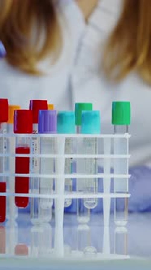 Test Tubes with Blood Samples in Rack