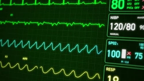 Medical Heart Rate Monitor 4