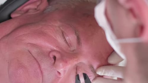 A Plastic Surgeon Examines the Sagging Skin in the Eye Area and Measures It with a Caliper