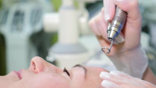 Beautician in Gloves Conducts Laser Polishing Face Skin in Cosmetology Clinic Professional