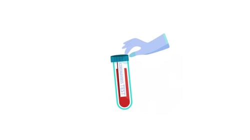 Animated Coronavirus Test Tube with Dripping Blood