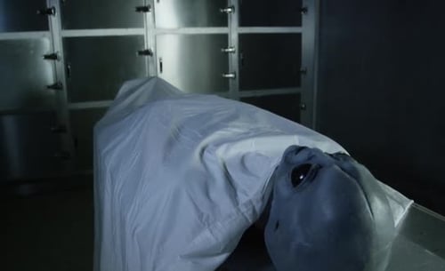 Area 51 Alien Autopsy - Tilt up from alien on gurney
