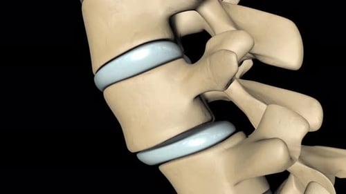 Medical 3D Animation of Spine Pathology and Scoliosis