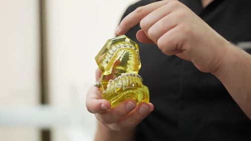 Manos de un trabajador médico sujetando mandíbulas humanas, modelo de plástico amarillo con tirantes metálicos instalados