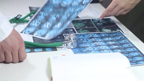 Doctors Are Studying With A Brain Diagram In The Office