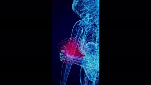 Digital X-Ray Scan of Human Arm with Elbow Pain