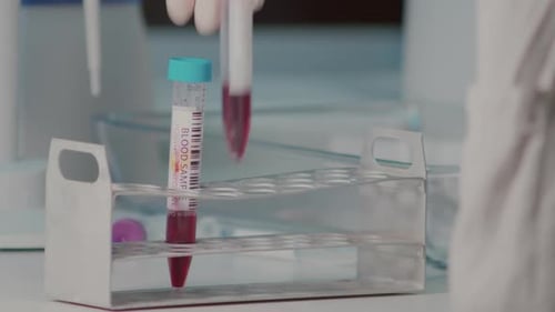 Blutprobe im Reagenzglas und Handaufnahme, Nahaufnahme