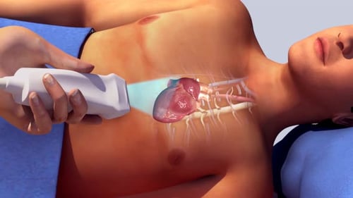 Medical professional performing heart ultrasound examination