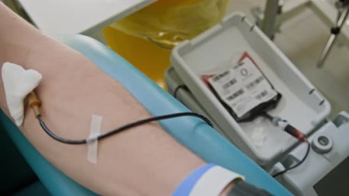 Nahaufnahme eines nicht erkennbaren Arms mit eingesetzter Nadel, der mit dem Blutbeutel verbunden ist