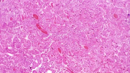 Glande pituitaire humaine en coupe transversale filmée au microscope avec un grossissement de 100x
