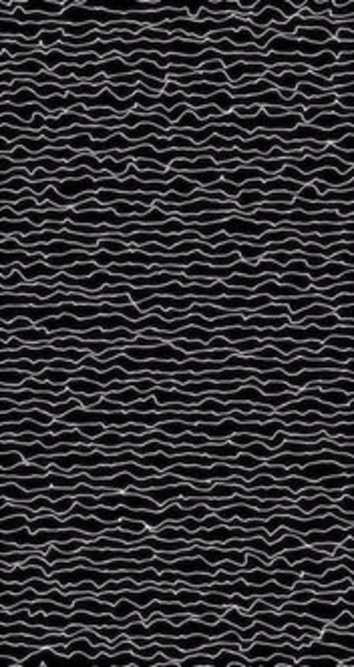 Abstract Moving Wavy Lines Vertical Loop Background