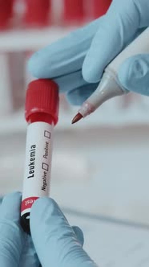 Leukemia Test in Lab Being Marked Positive