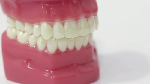 Dental Model with Clear Aligners